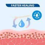 Hydrocolloid Adhesive Bandages for Fast Wound Healing