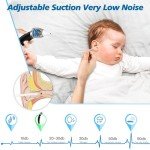 Electric Ear Vacuum Wax Remover with Strong Suction