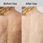 Exfoliating Shower Towel Set for Smooth Skin