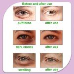 Watermelon Reusable Hot and Cold Eye Pads