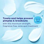Acne Spot Treatment Gel with 10% Benzoyl Peroxide