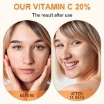 Vitamin C & Hyaluronic Acid Face Serum, 60ml