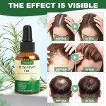 Rosemary Essential Oil for Hair Growth