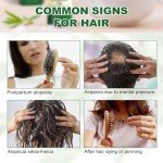 Rosemary Essential Oil for Hair Growth