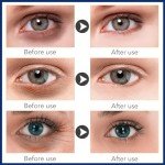 Under Eye Cream for Dark Circles & Wrinkles