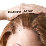 Natural Hair Tonic for Growth and Thickness