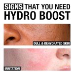 Neutrogena Hydro Boost Hydrating Gel Cleanser 7.8 oz