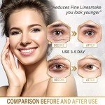 Gold Under Eye Masks for Puffiness & Dark Circles