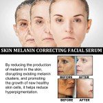 Melanin Correcting Facial Serum for Dark Spots
