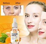 Turmeric Dark Spot Corrector Serum for All Skin