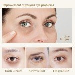 30 Pairs Gold Eye Masks for Puffiness & Circles