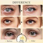 24K Gold Under Eye Patches - 15 Pairs