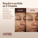Ambi Even & Clear Fade Cream for Dark Spots