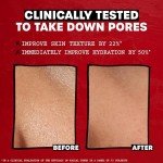 Rose Petal Witch Hazel Toner for Glowing Skin