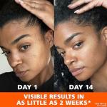 Palmer's Skin Success Anti-Dark Spot Cream, 2.7 oz