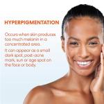 Palmer's Skin Success Anti-Dark Spot Cream, 2.7 oz