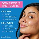 Peach Slices Acne Spot Dots - 30 Ct