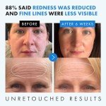 Affordable Hyaluronic Acid Face Serum - Anti Aging