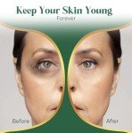 Gold Under Eye Patches for Puffiness (24 Pairs)