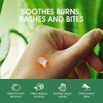 Aloe Vera Gel for Sunburn Relief and Moisturizing