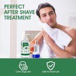 Aloe Vera Gel for Sunburn Relief and Moisturizing