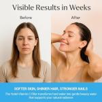 Yodel Vitamin C Shower Head Water Filter