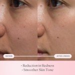 ELEMIS Pro-Collagen Rose Micro Serum for Hydration