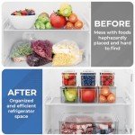 10 Pack Stackable Clear Refrigerator Organizer Bins