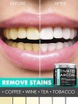 Remineralizing Teeth Whitening Powder - 5 in 1