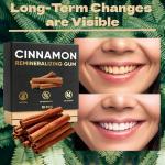 Cinnamon Remineralizing Gum with Hydroxyapatite & Xylitol