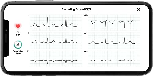KardiaMobile Six-Lead EKG Monitor for AFib Detection