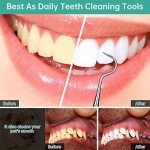 Dental Scraper Tool - Stainless Steel Stain Remover