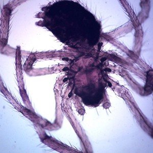 Whole-Mount Spider Microscope Slide