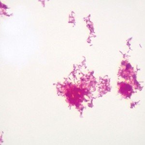 Acid Fast Stain Microscope Slide, W.M