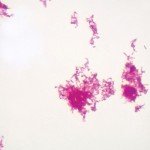 Acid Fast Stain Microscope Slide, W.M