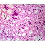 Acid Fast Stain Microscope Slide, W.M