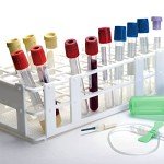 Acrux7 6-Pack Detachable Test Tube Rack