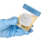 Sterile Specimen Cups with Lids - 5 Count