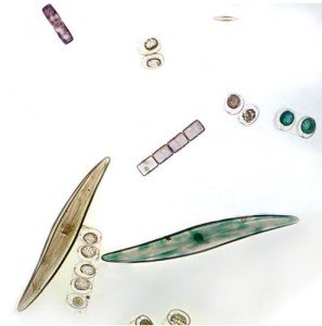 Freshwater and Marine Diatoms Microscope Slide