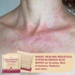 Hypochlorous Acid Skin & Face Cleaning Wipes