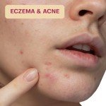Hypochlorous Acid Skin & Face Cleaning Wipes