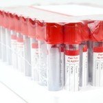 Meterbox 5ml Blood Collection Tubes for Pets – 100 Pcs