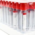 Vacutainer Blood Collection Tubes 10ml, 100 Pcs