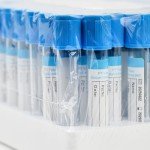 5ml Vacutainer Blood Collection Tubes - 100 Pcs