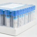 Vacutainer Blood Collection Tubes 3ml for Labs