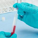 Globe Scientific LDPE Fine Tip Transfer Pipettes - 500 Pack