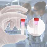 PATIKIL 0.5mL Plastic Cryogenic Vials, 36 Pack