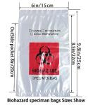 Biohazard Bags 15x25 cm with Red Print, 100 Count