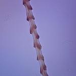 Hair Microscope Slide Set for Comparison