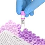 Micro Blood Collection Tubes 0.5ml EDTA K2